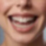 A close-up view of orthodontic braces on a dental model.