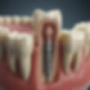 Dental root canal illustration showcasing procedure highlights