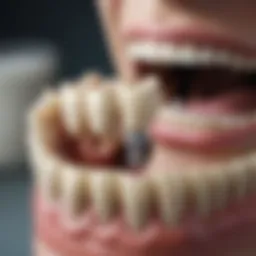 Understanding dental insurance coverage for root canal treatments