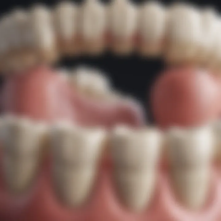 A close-up of a dental crown showcasing its design and material.